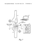 SENSING MODULE HAVING A PIEZO-RESISTIVE SENSOR FOR ORTHOPEDIC LOAD SENSING INSERT DEVICE diagram and image