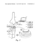 SENSING MODULE HAVING A PIEZO-RESISTIVE SENSOR FOR ORTHOPEDIC LOAD SENSING INSERT DEVICE diagram and image