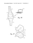 SENSING MODULE HAVING A PIEZO-RESISTIVE SENSOR FOR ORTHOPEDIC LOAD SENSING INSERT DEVICE diagram and image