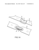 Band Clamp With Embedded Electronics diagram and image