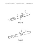 Band Clamp With Embedded Electronics diagram and image