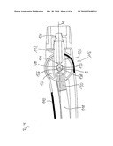 Expulsion apparatus diagram and image