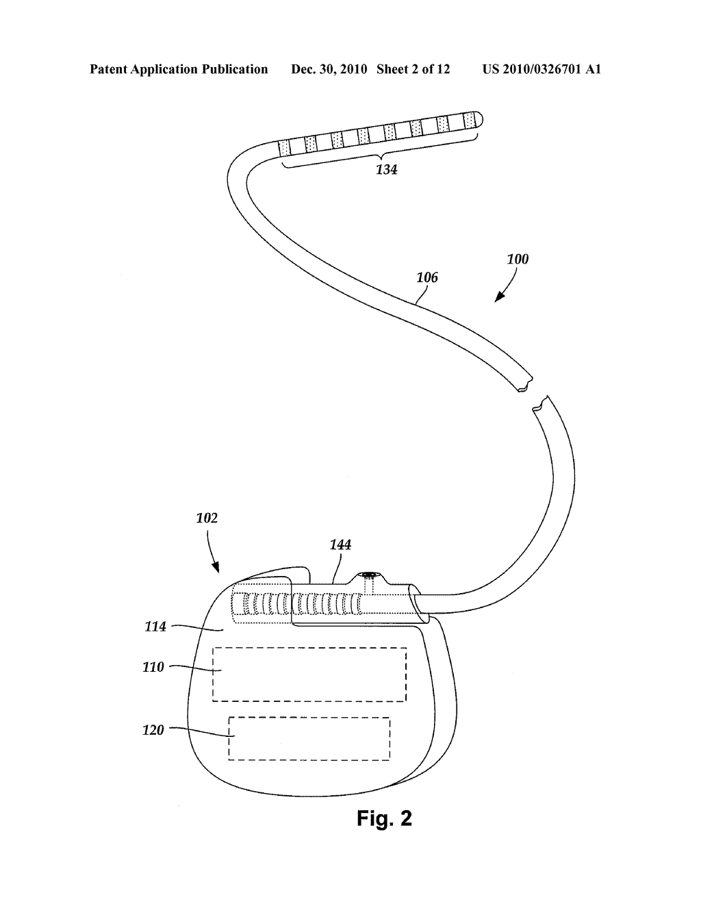 SYSTEMS AND METHODS FOR REMOVING INSULATION DISPOSED OVER CONDUCTORS OF IMPLANTABLE ELECTRIC STIMULATION SYSTEMS - diagram, schematic, and image 03