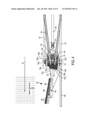 ION IMPLANTATION APPARATUS AND A METHOD diagram and image