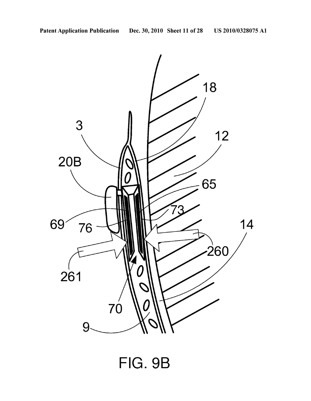 APNEA DETECTOR AND SYSTEM - diagram, schematic, and image 12