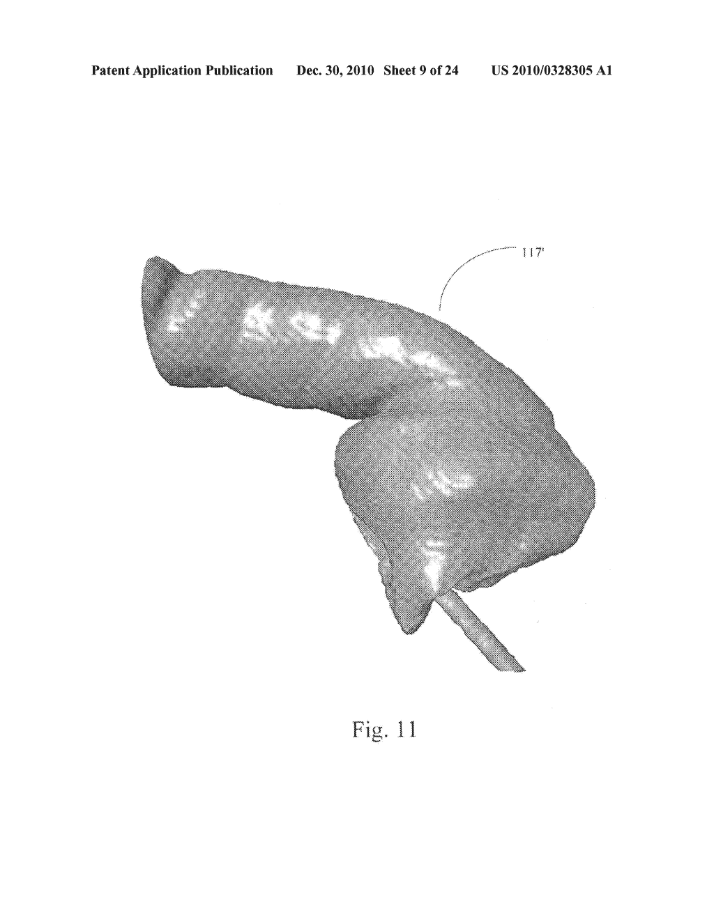 Method and System for Producing Interactive, Three-Dimensional Renderings of Selected Body Organs Having Hollow Lumens to Enable Simulated Movement Through the Lumen - diagram, schematic, and image 10