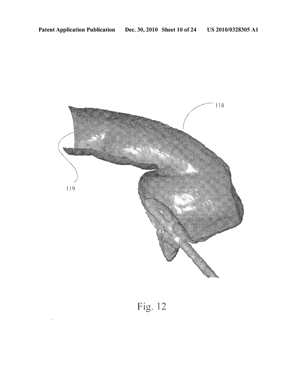 Method and System for Producing Interactive, Three-Dimensional Renderings of Selected Body Organs Having Hollow Lumens to Enable Simulated Movement Through the Lumen - diagram, schematic, and image 11