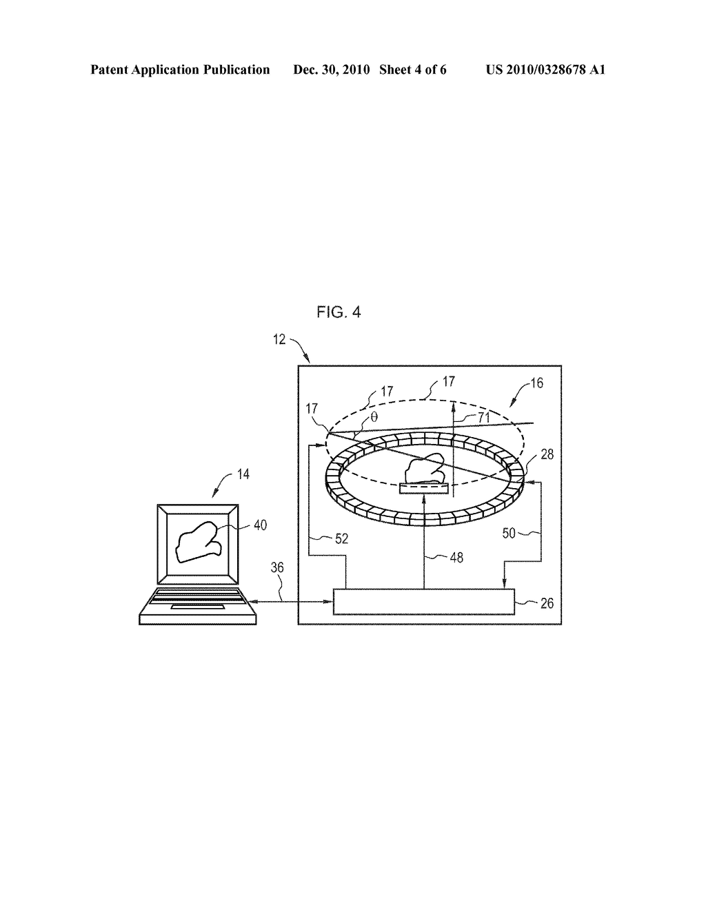 SYSTEM AND METHOD FOR THREE DIMENSIONAL RECONSTRUCTION OF AN ANATOMICAL IMPRESSION - diagram, schematic, and image 05