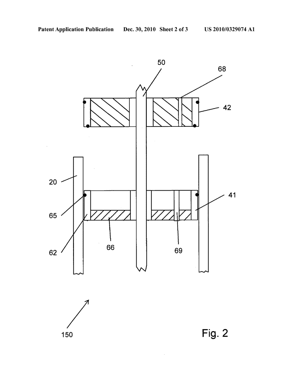 Device for Mixing and Dispensing Bone Cement - diagram, schematic, and image 03