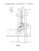 GAMMA CAMERA FOR PERFORMING NUCLEAR MAMMOGRAPHY IMAGING diagram and image