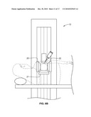 GAMMA CAMERA FOR PERFORMING NUCLEAR MAMMOGRAPHY IMAGING diagram and image