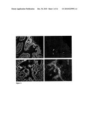 SHIGA TOXIN B-SUBUNIT AS A VECTOR FOR TUMOR DIAGNOSIS AND DRUG DELIVERY TO GB3 EXPRESSING TUMORS diagram and image