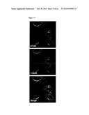 SHIGA TOXIN B-SUBUNIT AS A VECTOR FOR TUMOR DIAGNOSIS AND DRUG DELIVERY TO GB3 EXPRESSING TUMORS diagram and image