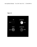 SHIGA TOXIN B-SUBUNIT AS A VECTOR FOR TUMOR DIAGNOSIS AND DRUG DELIVERY TO GB3 EXPRESSING TUMORS diagram and image