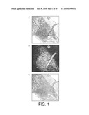 METHOD OF FIXING AND EXPRESSING PHYSIOLOGICALLY ACTIVE SUBSTANCE diagram and image