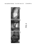 METHOD OF FIXING AND EXPRESSING PHYSIOLOGICALLY ACTIVE SUBSTANCE diagram and image