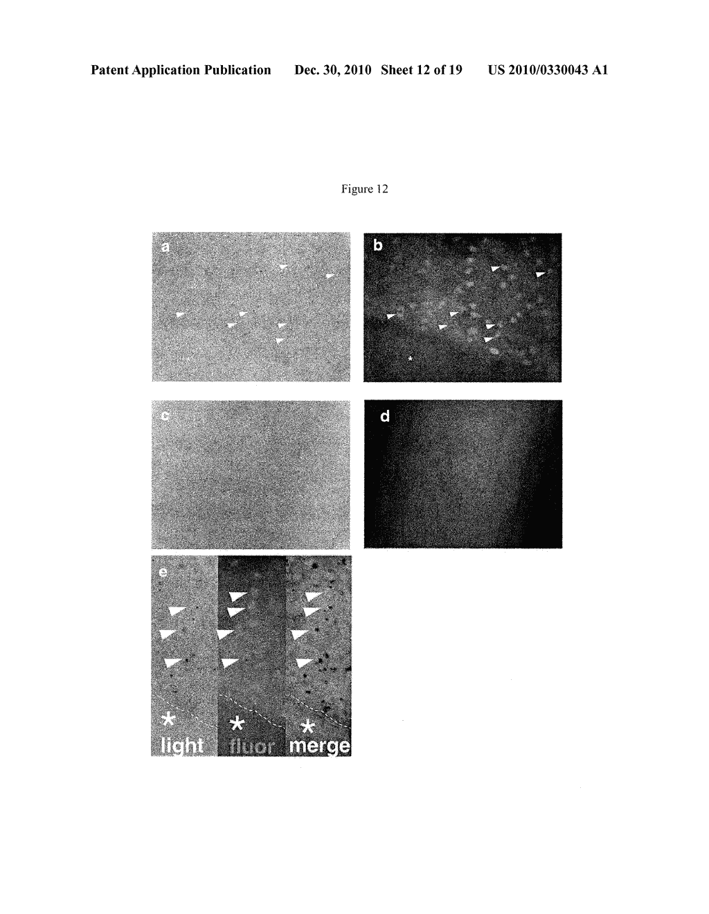 GPR125 AS A MARKER FOR STEM AND PROGENITOR CELLS AND METHODS USE THEREOF - diagram, schematic, and image 13