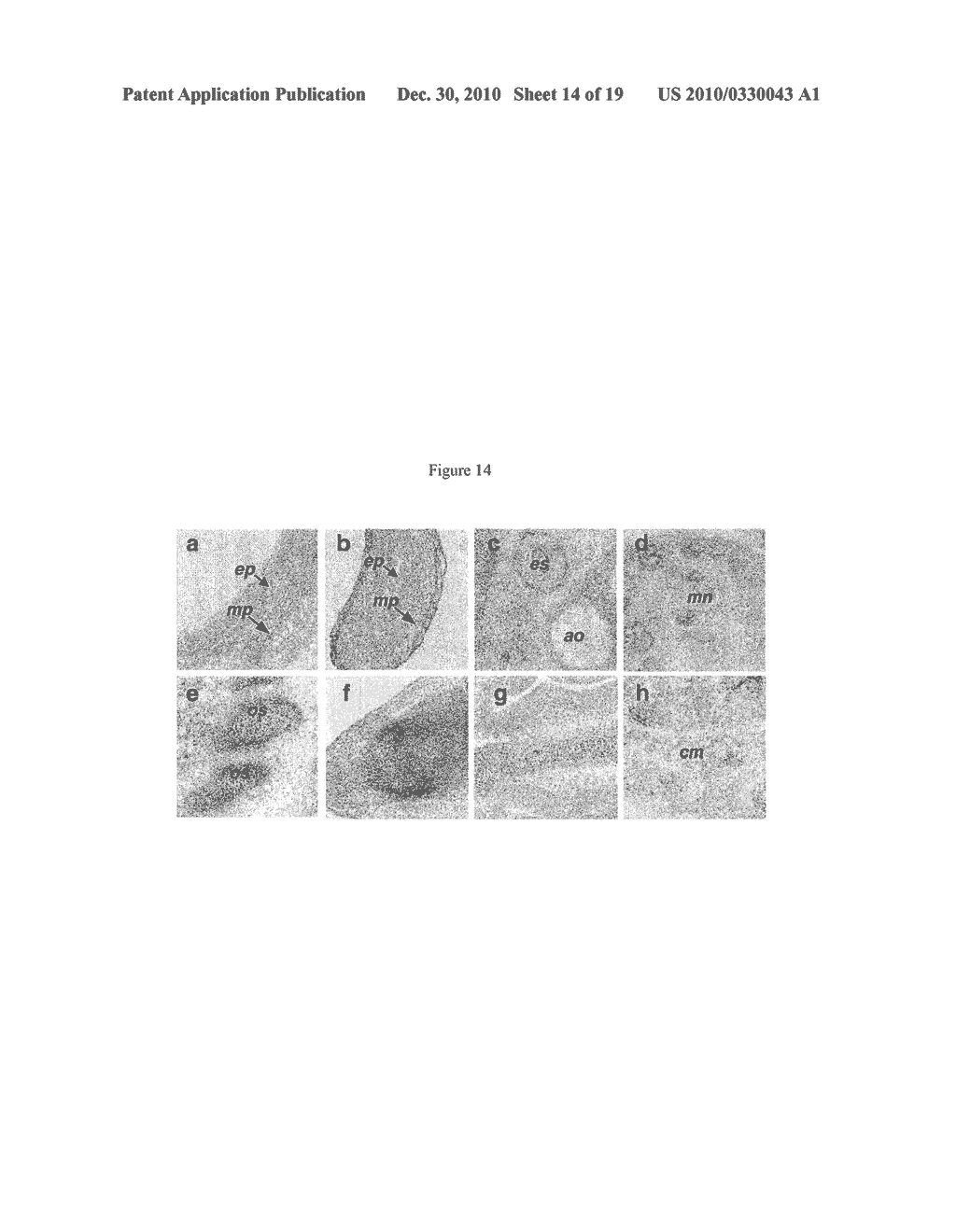 GPR125 AS A MARKER FOR STEM AND PROGENITOR CELLS AND METHODS USE THEREOF - diagram, schematic, and image 15