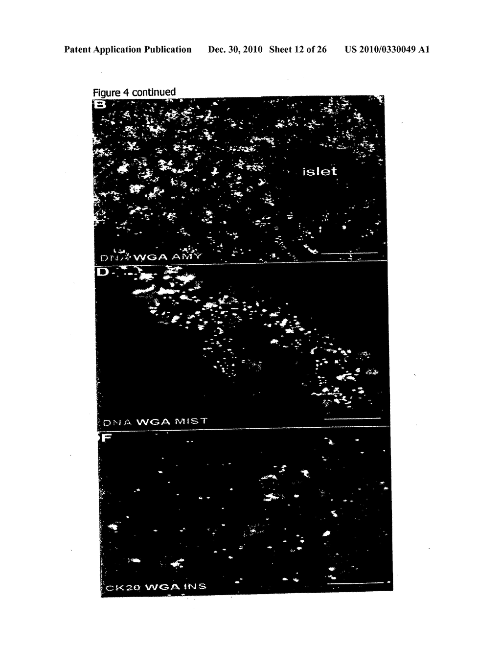 METHOD FOR GENERATING ISLET BETA CELLS FROM DEDIFFERENTIATED EXOCRINE PANCREATIC CELLS - diagram, schematic, and image 13