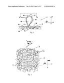 TUFTED FIBROUS WEB diagram and image