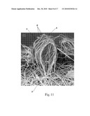 TUFTED FIBROUS WEB diagram and image