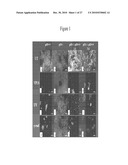 Use of Soluble Galectin-3 (Gal-3) for Cancer Treatment diagram and image