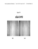 Use of Soluble Galectin-3 (Gal-3) for Cancer Treatment diagram and image