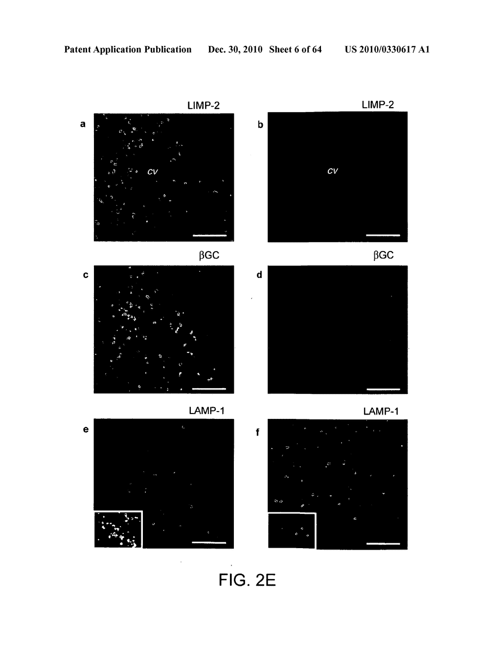 Methods of Producing a Secreted Protein - diagram, schematic, and image 07