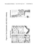 Differentiated Pluripotent Stem Cell Progeny Depleted of Extraneous Phenotypes diagram and image