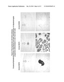 Differentiated Pluripotent Stem Cell Progeny Depleted of Extraneous Phenotypes diagram and image