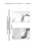 Differentiated Pluripotent Stem Cell Progeny Depleted of Extraneous Phenotypes diagram and image