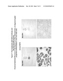 Differentiated Pluripotent Stem Cell Progeny Depleted of Extraneous Phenotypes diagram and image
