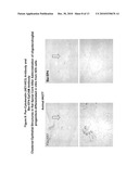 Differentiated Pluripotent Stem Cell Progeny Depleted of Extraneous Phenotypes diagram and image