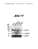 COMPLEXES OF TRPC DOMAINS AND SESTD1 DOMAINS AND METHODS AND USES INVOLVING THE SAME diagram and image