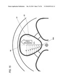 CENTRIFUGAL SEPARATOR diagram and image