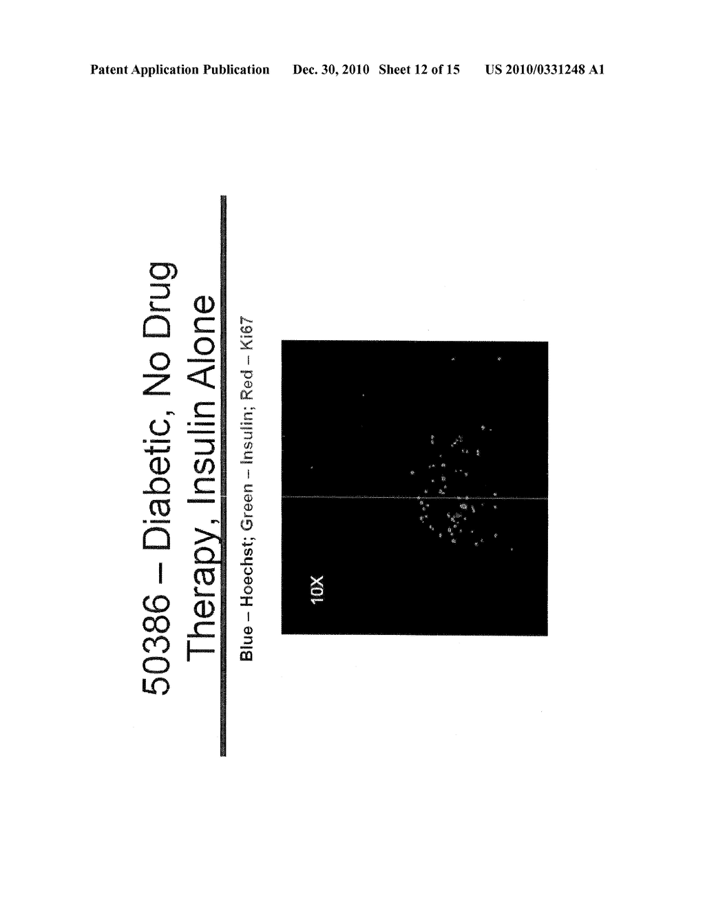 COMPOSITIONS AND METHODS FOR TREATING DIABETES USING LISOFYLLINE AND ISLET NEOGENESIS ASSOCIATED PEPTIDE - diagram, schematic, and image 13