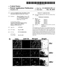 ZAP-70 AS PREDICTOR AND MODULATOR OF EFFECTOR FUNCTION OF T CELLS diagram and image