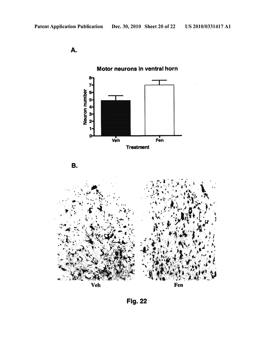 TREATMENT OF NEURAL DISEASES OR CONDITIONS - diagram, schematic, and image 21