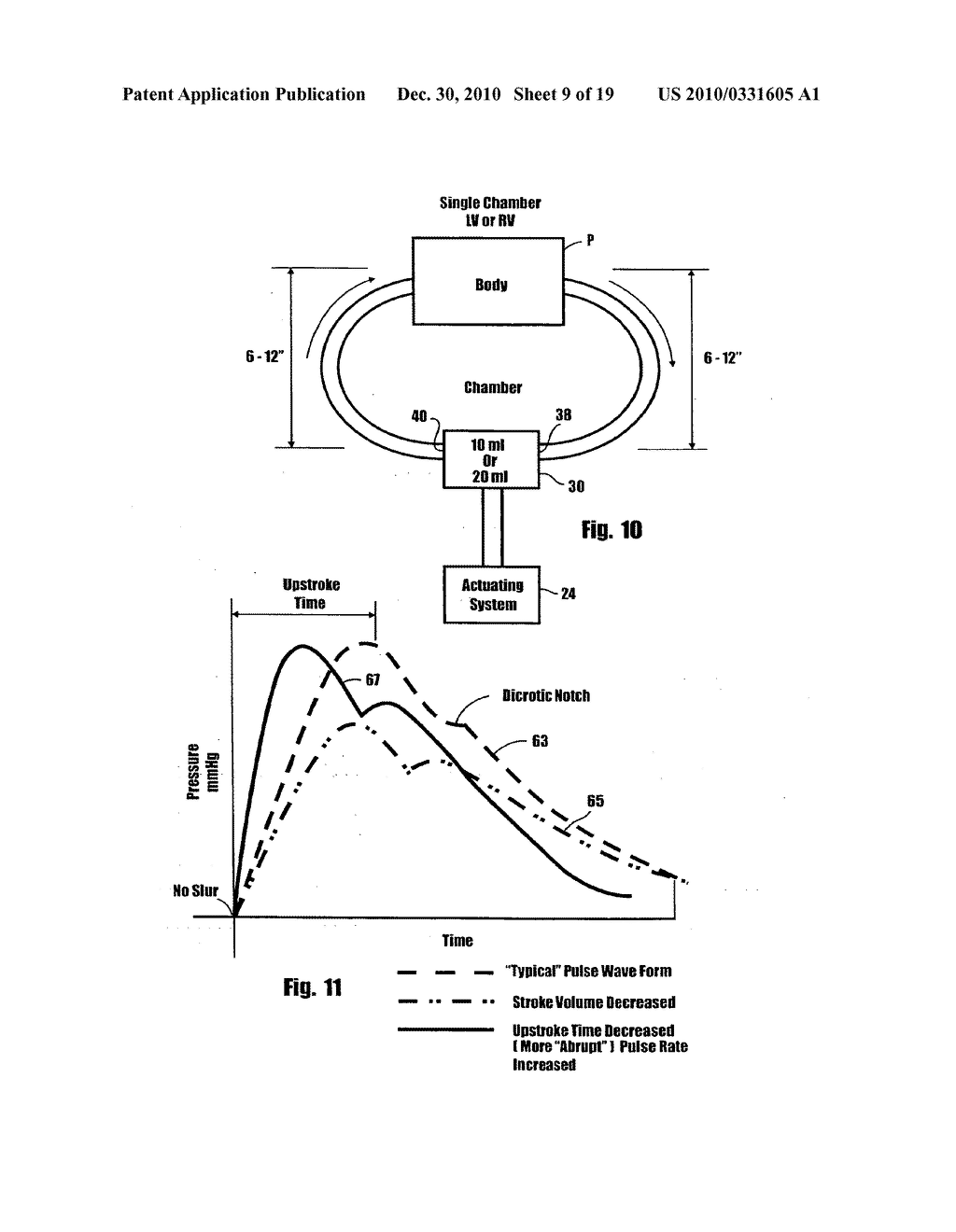 Physiologic pulsatile pump - diagram, schematic, and image 10