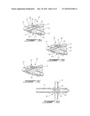 SURGICALLY IMPLANTABLE URETHRA PRESSURE CONTROL VALVE diagram and image