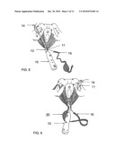 SYSTEM AND METHOD FOR TREATMENT OF ANAL INCONTINENCE AND PELVIC ORGAN PROLAPSE diagram and image