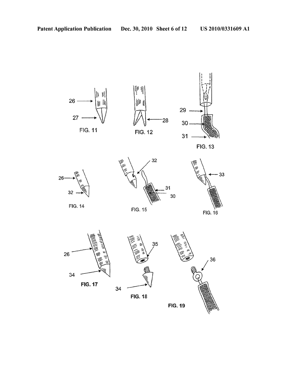 SYSTEM AND METHOD FOR TREATMENT OF ANAL INCONTINENCE AND PELVIC ORGAN PROLAPSE - diagram, schematic, and image 07