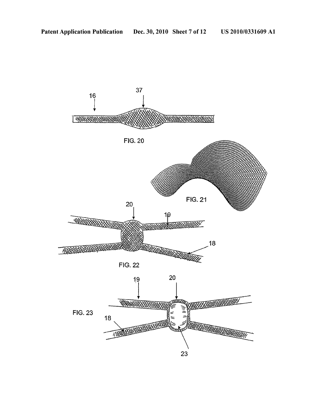 SYSTEM AND METHOD FOR TREATMENT OF ANAL INCONTINENCE AND PELVIC ORGAN PROLAPSE - diagram, schematic, and image 08