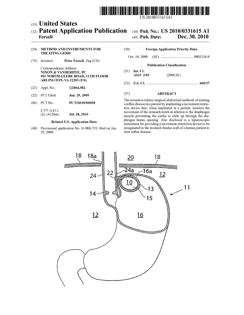 METHOD AND INSTRUMENTS FOR TREATING GERD - diagram, schematic, and image 01