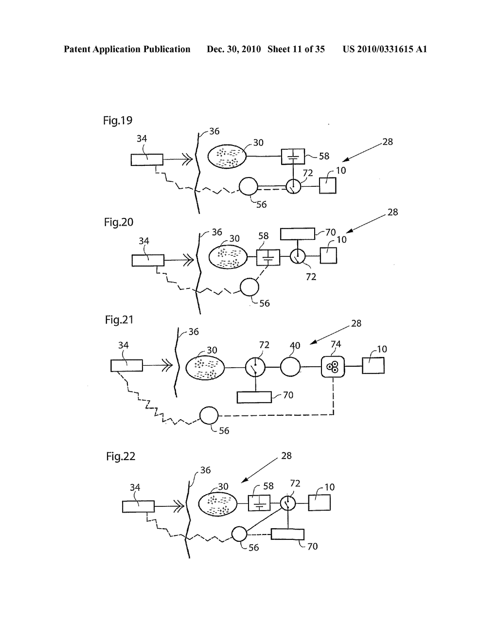 METHOD AND INSTRUMENTS FOR TREATING GERD - diagram, schematic, and image 12