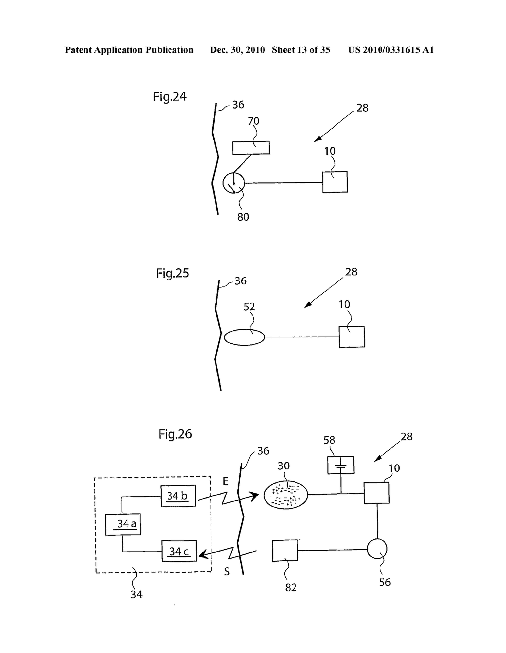 METHOD AND INSTRUMENTS FOR TREATING GERD - diagram, schematic, and image 14