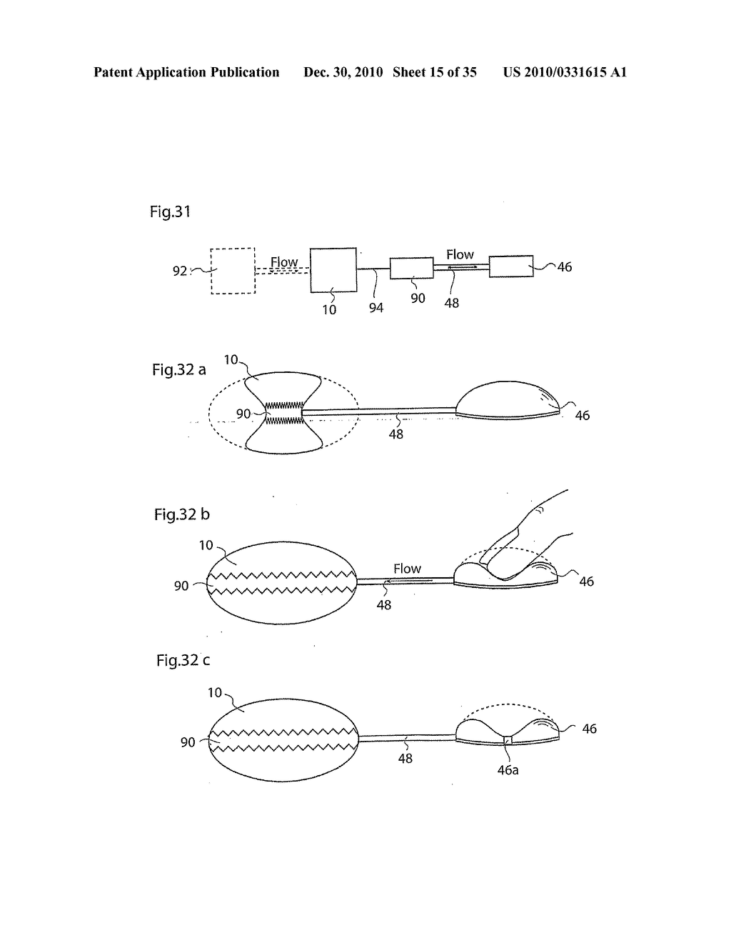 METHOD AND INSTRUMENTS FOR TREATING GERD - diagram, schematic, and image 16