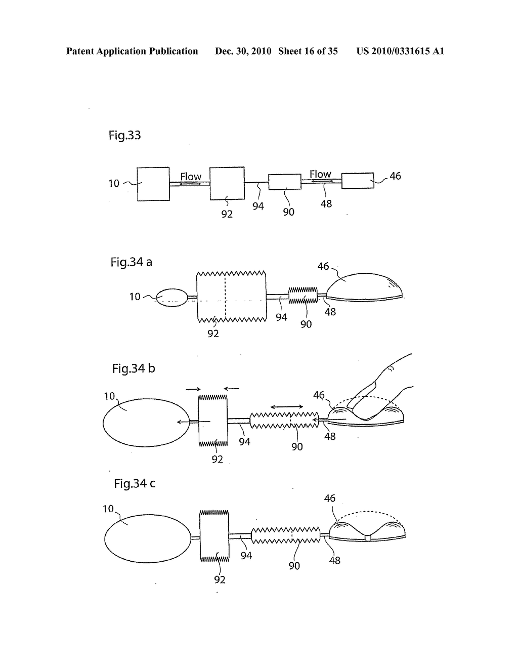 METHOD AND INSTRUMENTS FOR TREATING GERD - diagram, schematic, and image 17