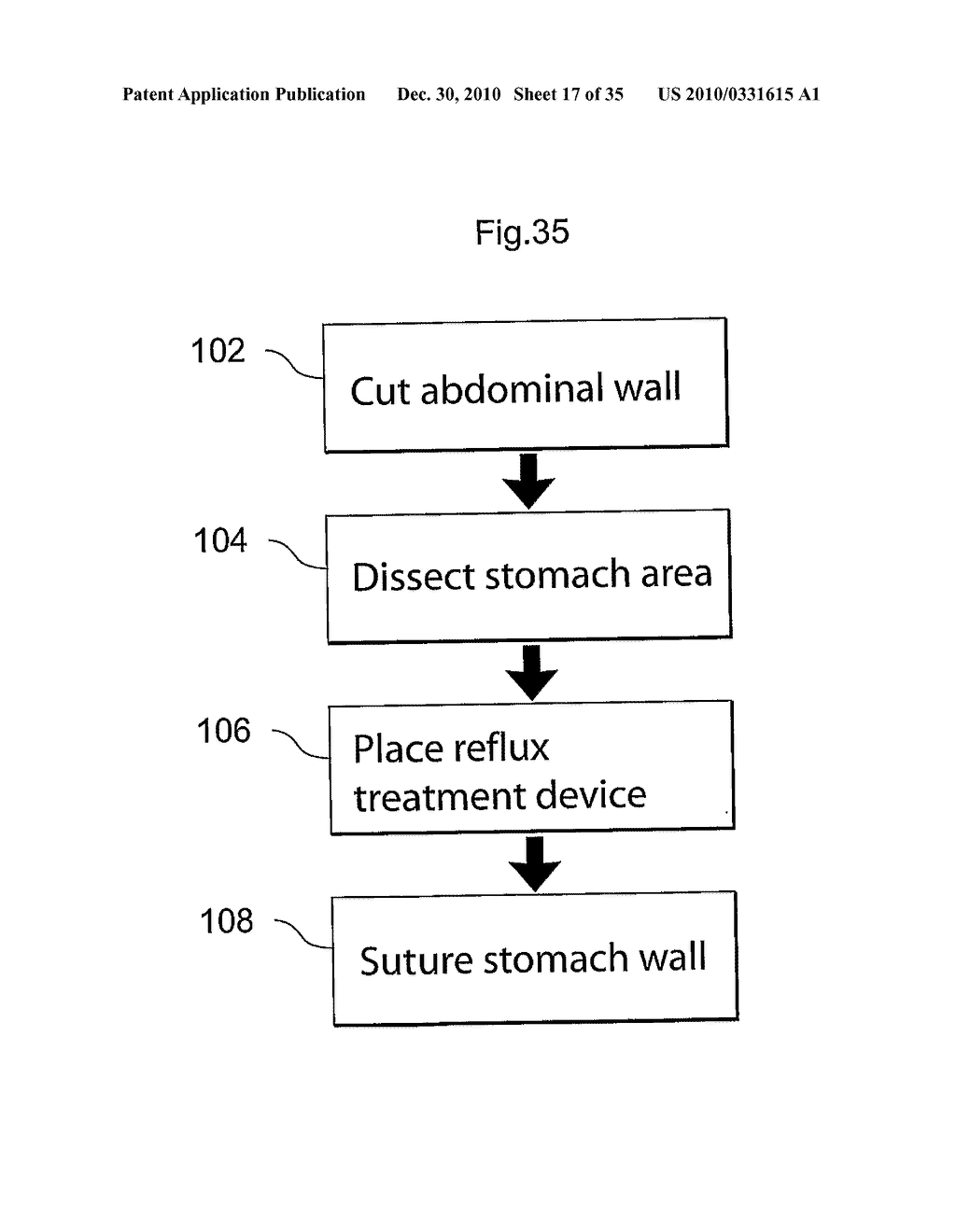 METHOD AND INSTRUMENTS FOR TREATING GERD - diagram, schematic, and image 18