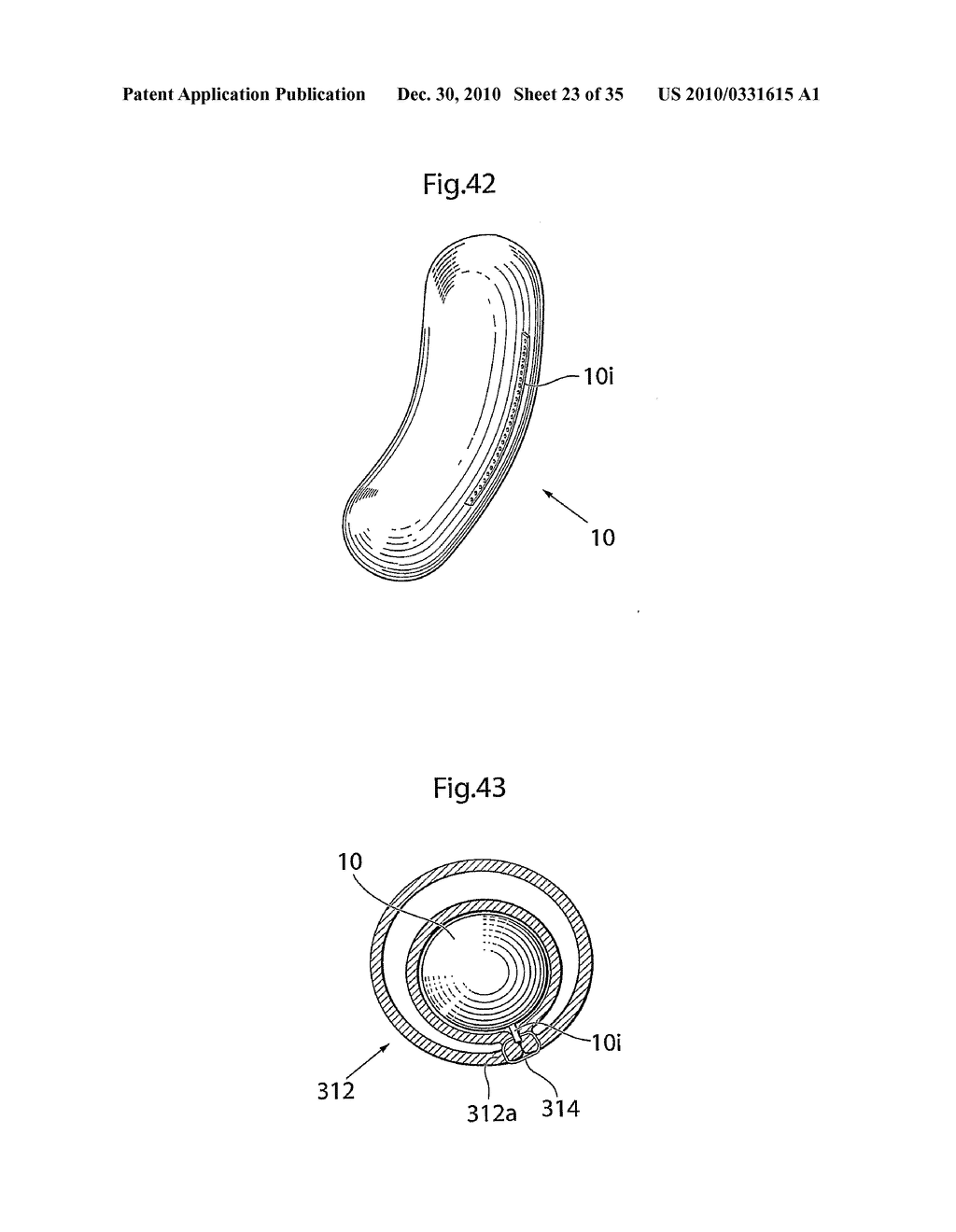 METHOD AND INSTRUMENTS FOR TREATING GERD - diagram, schematic, and image 24